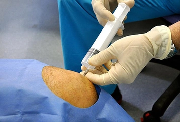 Eklem Sıvısının Özellikleri